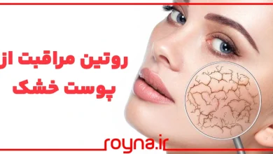 روتین مراقبت از پوست خشک؛ کی گفته پوست خشک نمیتونه خوشگل و زیبا بشه؟!