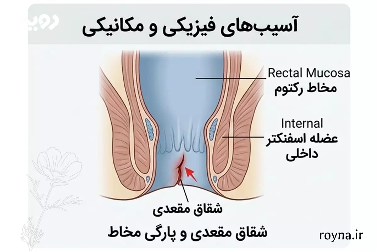 عوارض ریختن آب در عقب یا همان مقعد در رابطه جنسی 5 آسیب های فیزیکی رابطه مقعدی و ریختن مایع منی در عقب