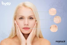 برای چروک صورت چی خوبه؟ [ترفند 100% تضمینی]