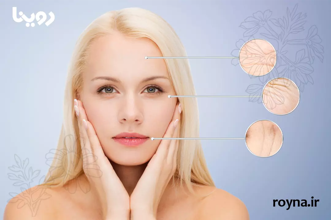 برای چروک صورت چی خوبه؟ [ترفند 100% تضمینی]