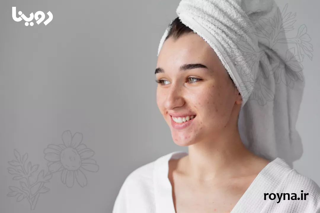 از بین بردن جوش برای همیشه؛ ترفندهای علمی و خانگی! 1