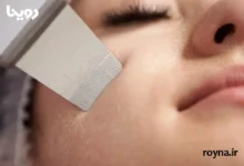 مقایسه اتو صورت یا میکرودرم برای ترمیم پوست