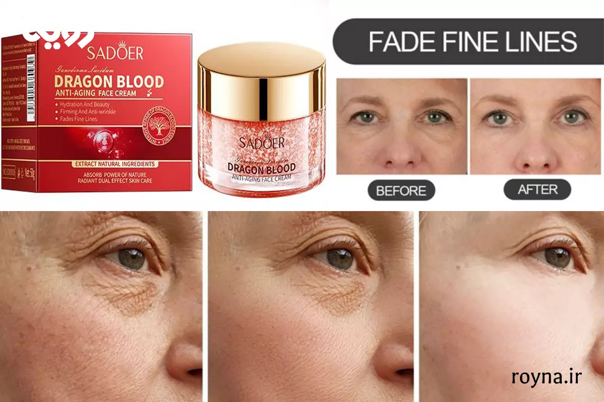 قبل و بعد استفاده از کرم خون اژدها روی جای جوش و زخم