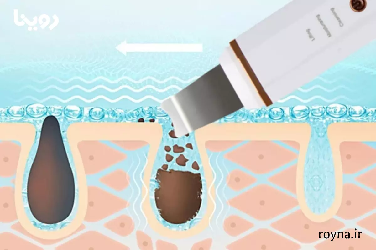 علائم هشدار عوارض اتو صورت روی صورت