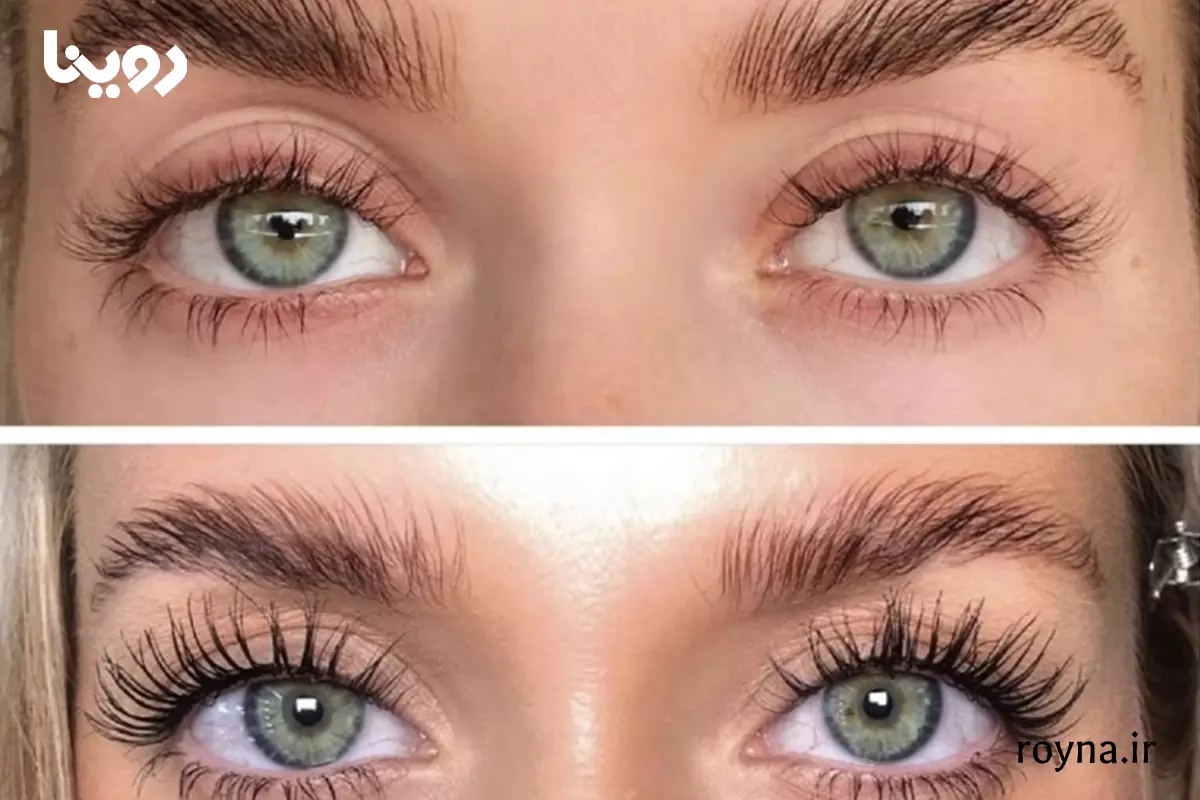 تقویت مژه لانبنا یا سریتا | 10 دلیل برای بهترین انتخاب! 5 نتیجه قبل و بعد استفاده از سرم تقویت مژه لانبنا و سریتا