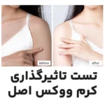 مقایسه قبل و بعد از استفاده کرم ووکس